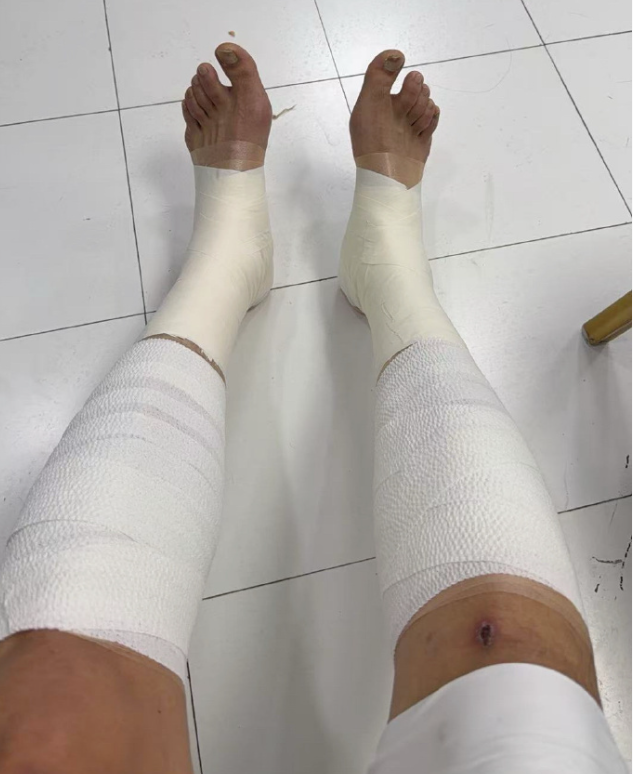 世界杯注册-太硬了！翟晓川双腿缠满绷带罚球制胜 5人伤停许利民盛赞全队坚韧